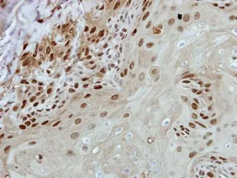 BRF2 antibody [N1C1]