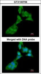 MMP3 antibody [N1], N-term