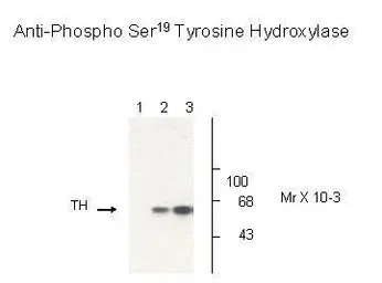 TPH2 (phospho Ser19) antibody