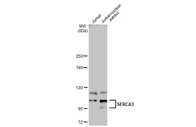 SERCA3 antibody [N1N2], N-term