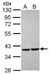 CRYZ antibody [N1C1]