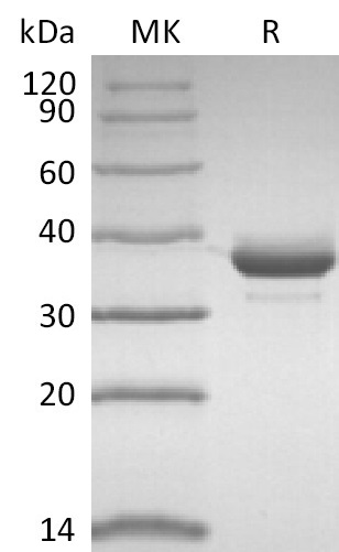 Recombinant Human CD81 (N-FC)(