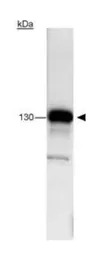 FANCJ antibody [pp15-IB4]