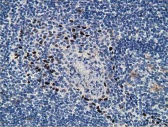 ZIM2 antibody [5E12]