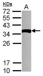 TXNDC6 antibody