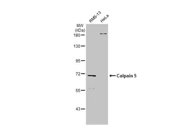 Calpain 5 antibody [N1C1]