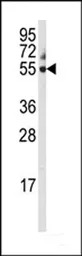 Cytochrome P450 3A5 antibody, 