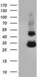 UCK1 antibody [5E9]