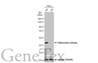 Adenosine kinase antibody