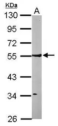 ARHGAP1 antibody [N3C3]