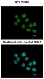 CREST antibody [N1C2]