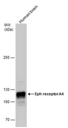 EphA4 antibody [N3C2], Interna