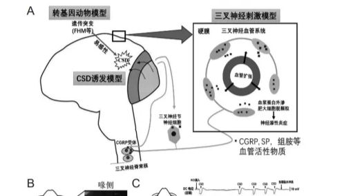 动物模型 ｜ 一文了解偏头痛动物模型构建