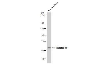 Frizzled 10 antibody