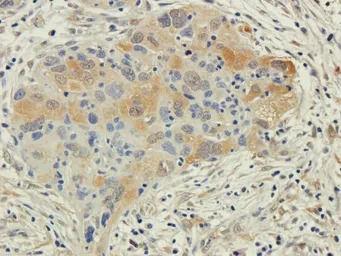 EPO receptor antibody