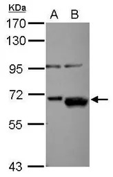 AKT2 antibody