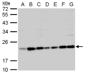 Bid antibody [N1C3-2]