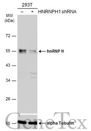 hnRNP H antibody [N1C1]