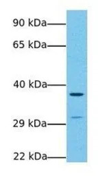 Wnt7b antibody, Internal