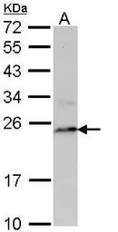 PSMB8 antibody [N2C3]