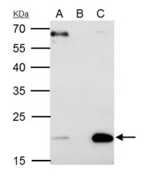 Sorcin antibody [N1C3]