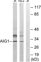 AIG1 antibody
