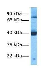 SQLE antibody, C-term