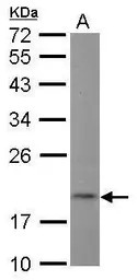 NT5C antibody [N1C3]