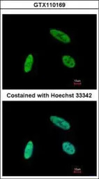 NCOA62 antibody