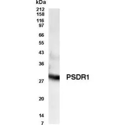RDH11 antibody