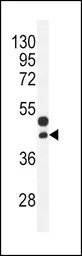 CTGF antibody, Internal