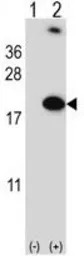 RBM3 antibody, Internal