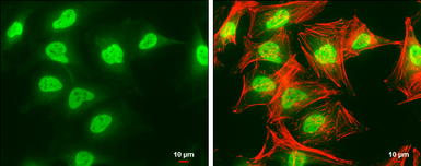 SET antibody, isoform 2-specif