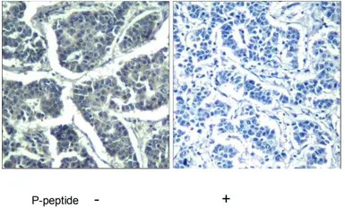 PLCG2 (phospho Tyr1217) antibo
