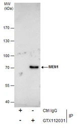 Menin antibody [N1C1]
