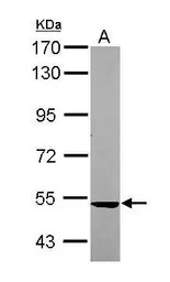 SARS2 antibody [N1C1]