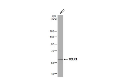 TBLR1 antibody [N3C3]