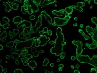 pan Cytokeratin antibody [PCK-