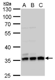 Annexin V antibody