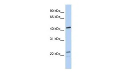 BCKDHA antibody, N-term