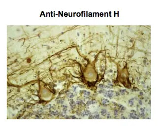 NF-H antibody [NAP4]