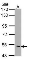 CHRND antibody [C3], C-term