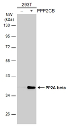 PP2A beta antibody