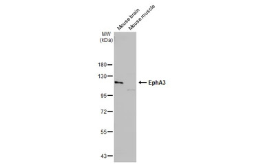 EphA3 antibody [N1N3]
