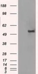 GLUT5 antibody [20E1]