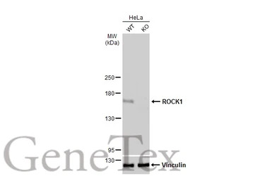 ROCK1 antibody [N1N2], N-term
