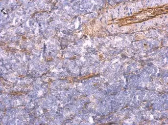 TNFAIP2 antibody [C1C3]