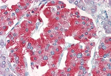 VMAT2 antibody, C-term