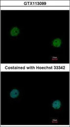 VCP antibody [N3C2], Internal