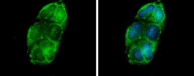 Glycerol kinase antibody [N1N3